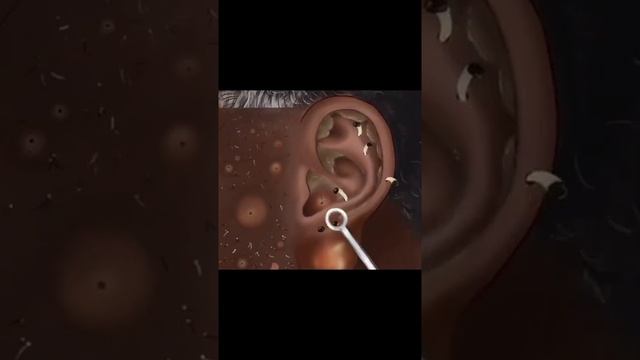 [ASMR] HEAD CLEANING FROM LICE AND ACNE | ЧИСТКА ГОЛОВЫ ОТ ВШЕЙ И ПРЫЩЕЙ смотреть онлайн