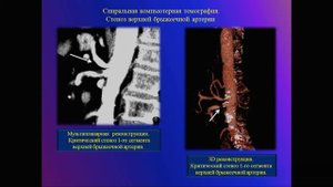 Лекция: Острое нарушение мезентериального кровообращения