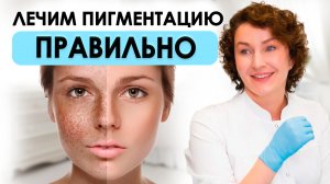 ПИГМЕНТАЦИЯ КОЖИ: Основные ПРИЧИНЫ и Эффективное ЛЕЧЕНИЕ