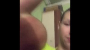 Кирилл Терешин Что с ним случилось? Мертв ? ампутация рук ( руки-базуки R.I.P. )