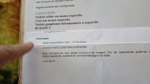 Cancer de Mama ( BIRADS 5) para Fibroadenoma.- Cura Divina