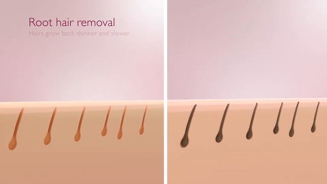 Эпилятор Philips HP6423/00 купить в Молдове смотреть онлайн