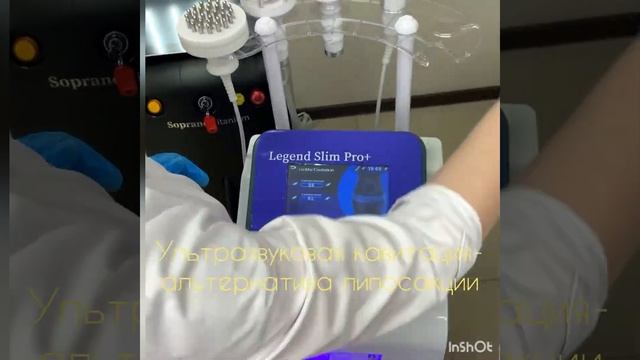 Лазерная эпиляция на аппарате Soprano Titanium смотреть онлайн