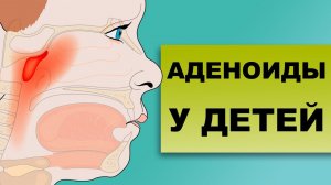 ПРИЧИНЫ АДЕНОИДОВ У ДЕТЕЙ