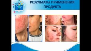 Водный баланс организма. Роль воды