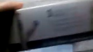 Портативная лазерная ручка для удаления прыщей Saint Health KD 7910