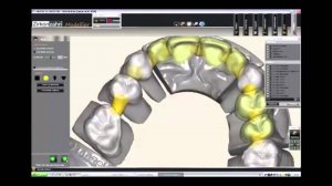 3D проектирование и моделирование зубных конструкций  CAD CAM технологии