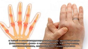 Боль в суставах рук: как ее лечить