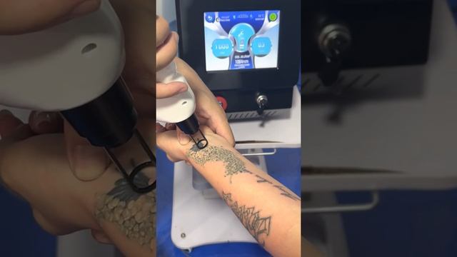 ipl shr+nd yag laser+rf 3 in 1 multifunctional beauty machine operation 。广州林光脱毛仪器工厂，康少林：191 2887119 смотреть онлайн