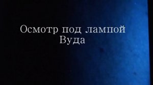 отрубевидный лишай осмотр под лампой Вуда