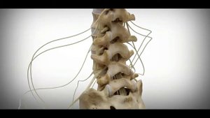 Фораминальный стеноз