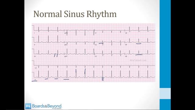 Кардиология USMLE - 3. ЭКГ - 2.ЭКГ: ВЫСОКОУРОЖАЙНОЕ