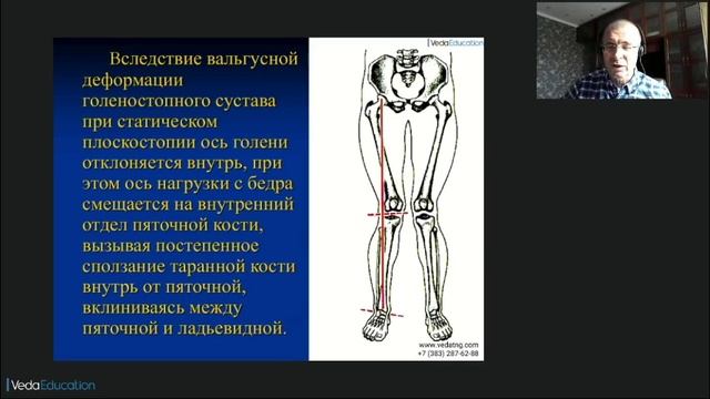 Нейроортопедические подходы мануальной терапии