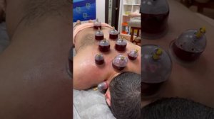 Хиджама кедровая бочка массаж
