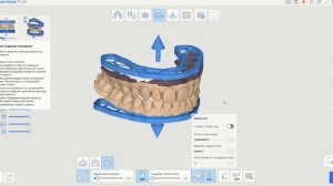 Модели для печати за 2 Минуты в Medit. Бесплатная программа подготовки моделей
