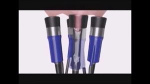 Сосковая резина