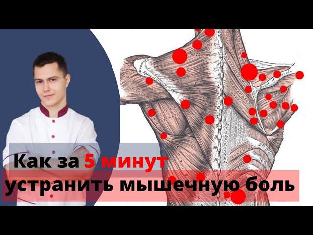 Тригерные точки в мышцах: как быстро найти и устранить мышечную боль. смотреть онлайн