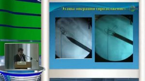 Феофилов И В - МКБ в структуре заболеваемости Новосибирской области и методы ее лечения на совреме