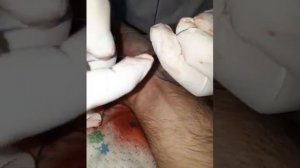травма на производстве