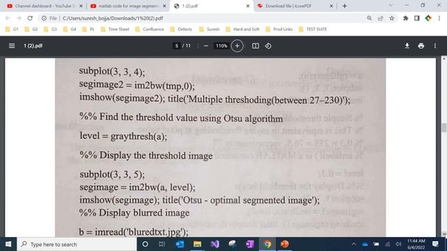 #ImageSegmentationMatlabcodeopenboxeducation Matlabcode - Image Segmentation смотреть онлайн