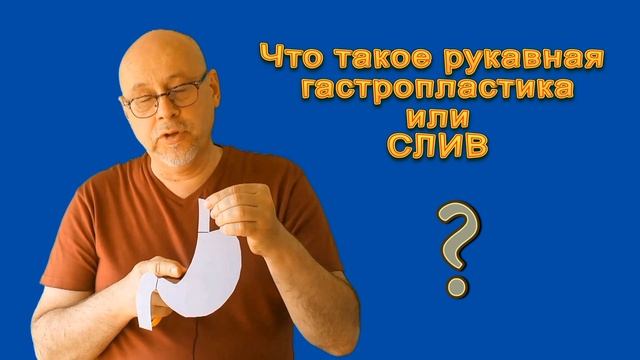 что такое СЛИВ рукавная гастропластика, продольная резекция желудка