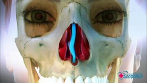 Исправление носовой перегородки. Здоровье. Фрагмент выпуска от 18.06.2017