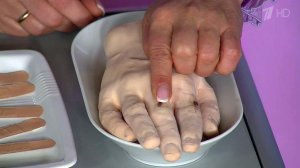 Как удалить занозу подручными средствами. Жить здорово! Фрагмент выпуска от 23.09.2016