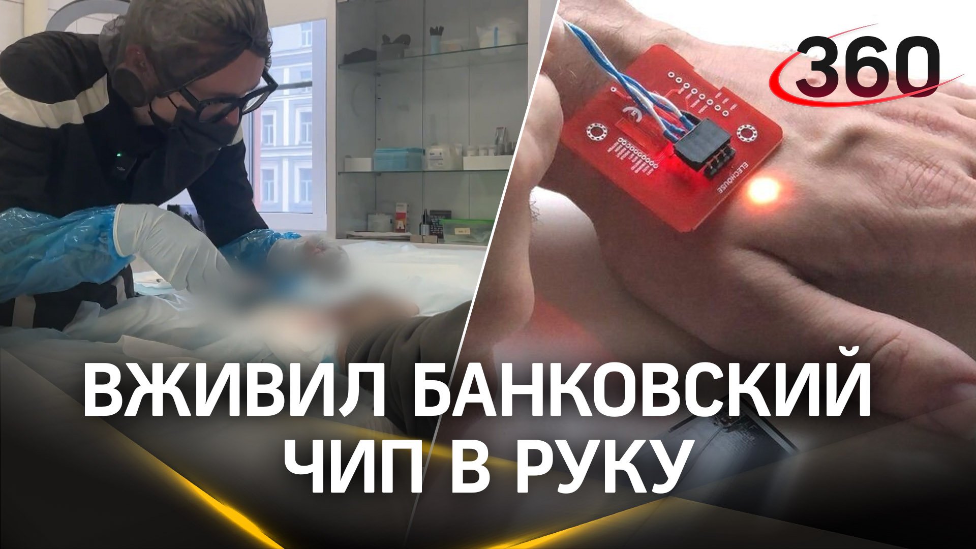 Россиянин вживил под кожу банковский чип по совету ИИ