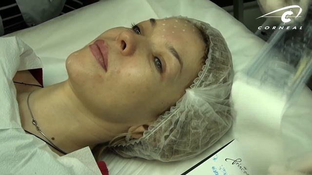 Почему разметка на лице может мешать смотреть онлайн