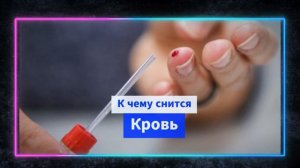 кровь во  сне - К чему снится кровь