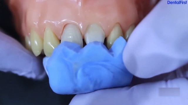 Structur 2 - эстетика временных конструкций смотреть онлайн