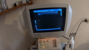 УЗД-аппарат Toshiba Nemio SSA-550A
