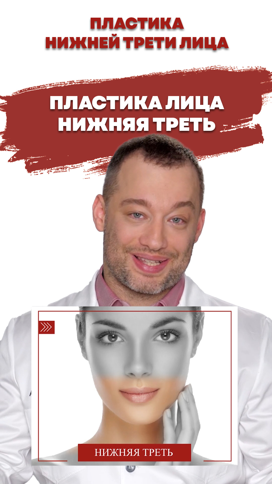 Пластика лица. Нижняя треть
