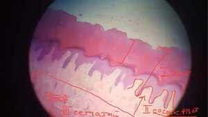 Общие препараты. Кожа тонкая и толстая