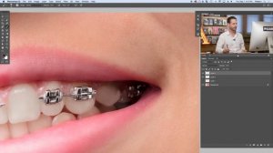 How to Remove Braces in Photoshop