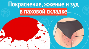 ? Покраснение, жжение и зуд в паховой складке. Клинический случай №1059