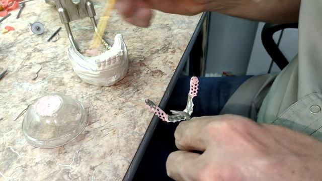 Изготовление бюгельного протеза  Покрываем сёдла лаком
