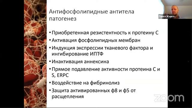Вебинар с международным участием "Круглый стол: тромбофилии, проблема диагностики АФС. Взгляд клини смотреть онлайн