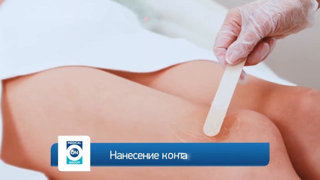 Лазерное удаление сосудов смотреть онлайн