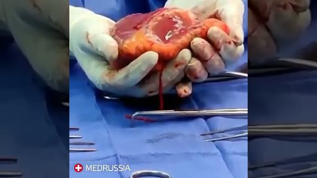 Сердечный автоматизи смотреть онлайн