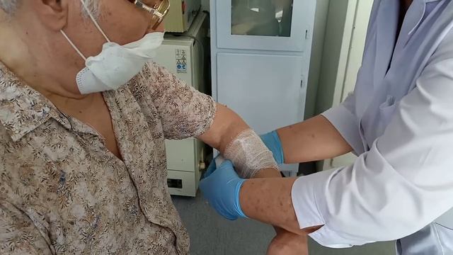 Черепашья повязка на локтевой сустав
