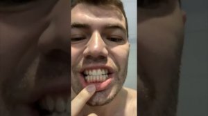 Лечебное голодание 12 дней, живая история