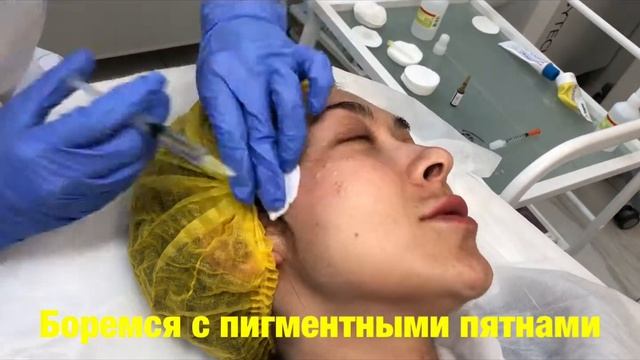 Биоревитализация в Екатеринбурге - Lerden центр эстетической косметологии смотреть онлайн