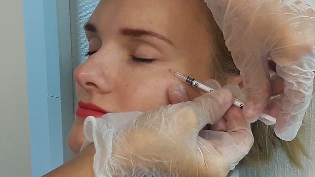 Аириском студенты учатся: демонстрация введения БОТОКСА клиенту смотреть онлайн