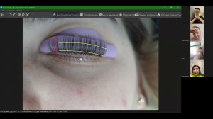 Разбор работы на валиках Vinog