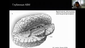 2022.02.28 АВМ головного мозга в анатомическом контексте (Аронов Моисей Соломонович).mp4