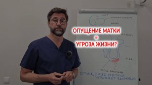 Опущение матки. Угроза здоровью и жизни