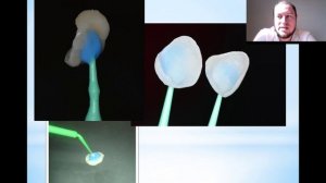 Вебинар Александра Павлова «От ОТТИСКА до ФИКСАЦИИ – ортопедические протоколы».