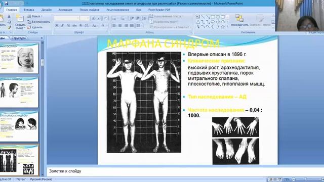 Типы наследования Синдромы и симптомы встречающиеся при различных типах наследования часть 2 смотреть онлайн