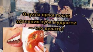 Опухла щека после удаления зуба мудрости — что делать?